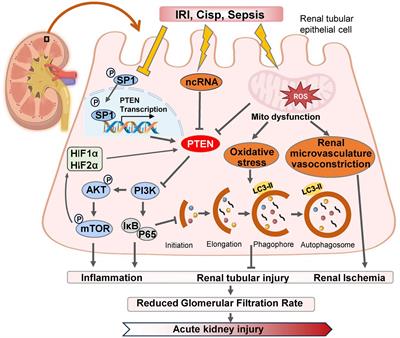 PTEN in kidney diseases: a potential therapeutic target in preventing AKI-to-CKD transition